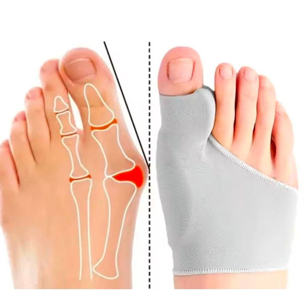 Bunion Sleeve | Hallux Valgus Toe Separator | Soft Gel Cushion | 1 Pair