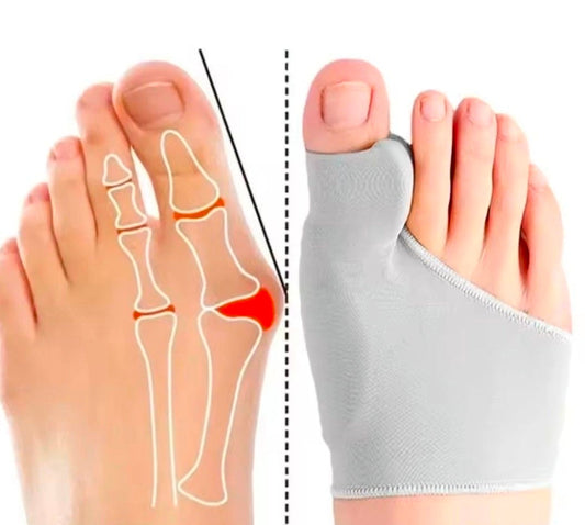 Bunion Sleeve | Hallux Valgus Toe Separator | Soft Gel Cushion | 1 Pair