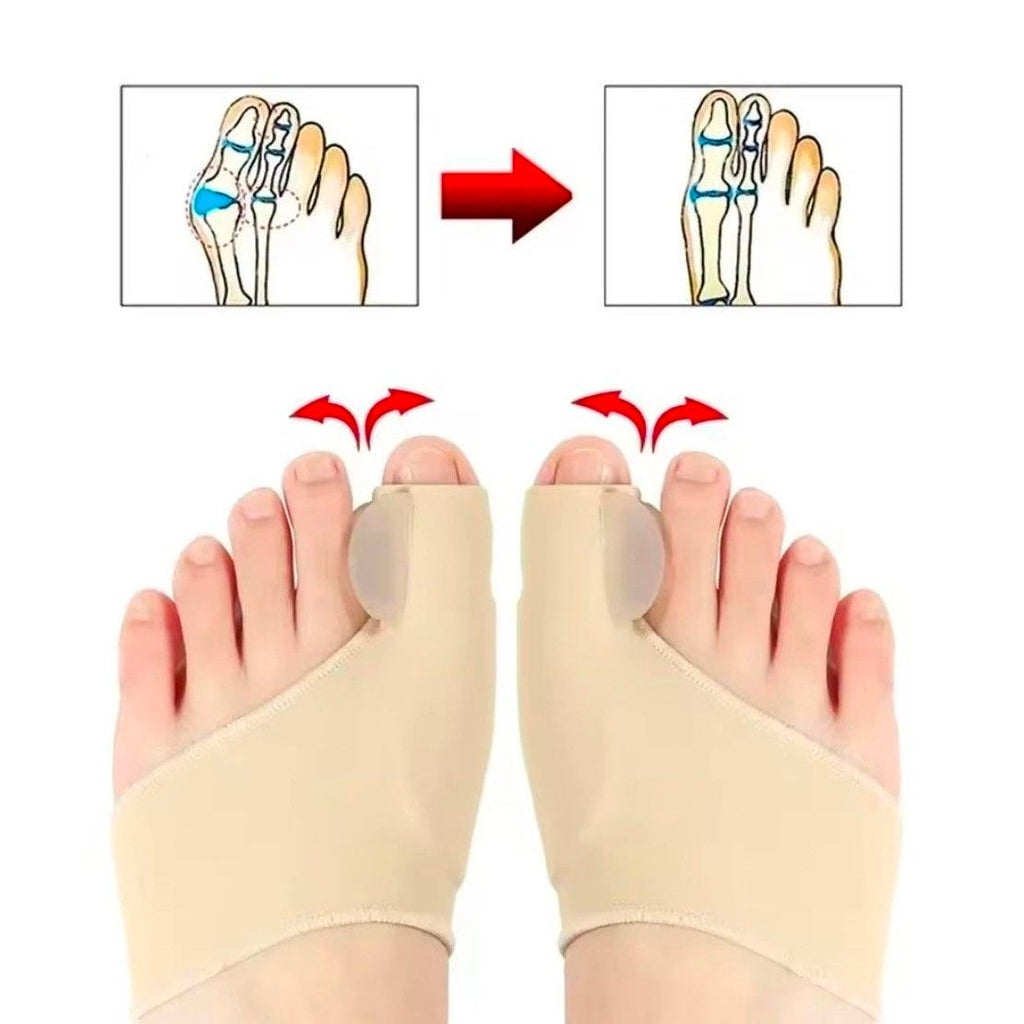 Bunion Sleeve | Hallux Valgus Toe Separator | Soft Gel Cushion | 1 Pair