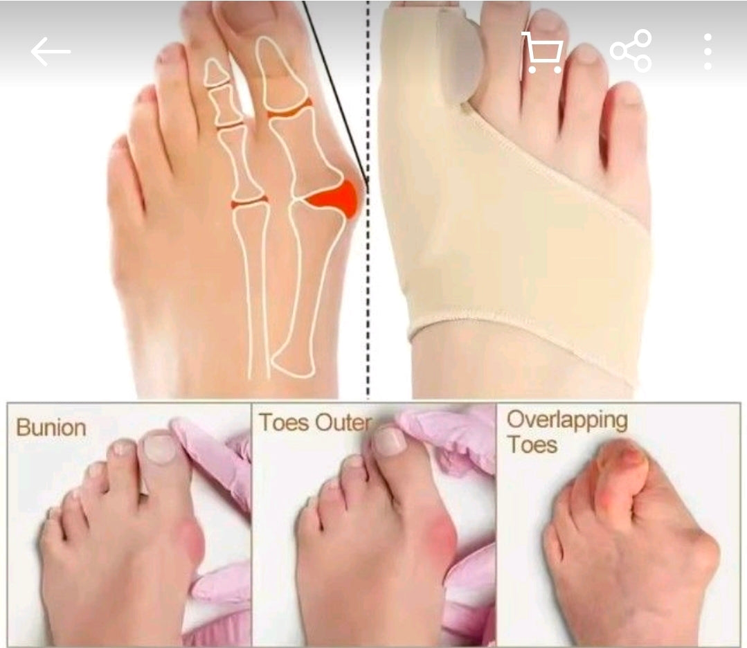 Bunion Sleeve | Hallux Valgus Toe Separator | Soft Gel Cushion | 1 Pair