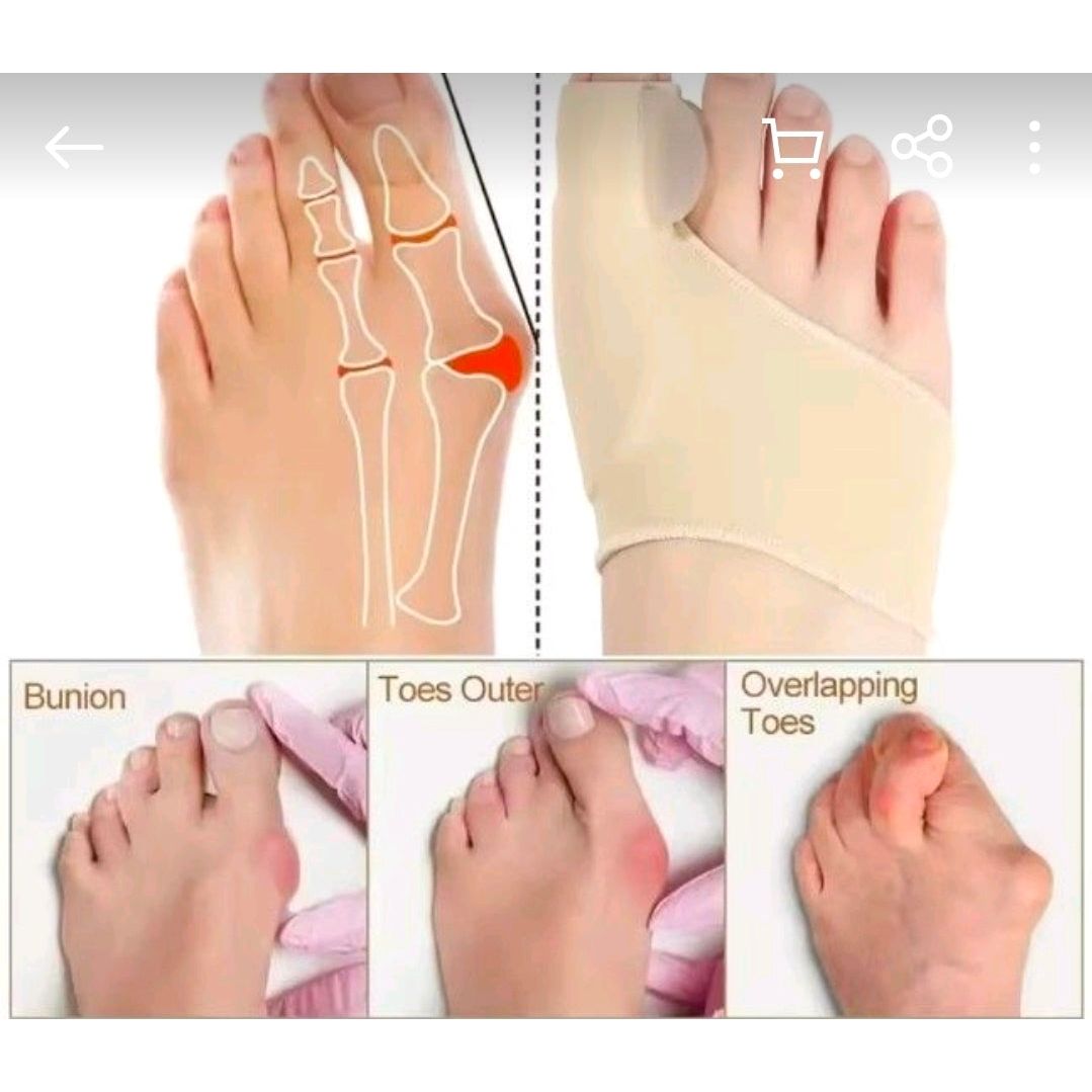 Bunion Sleeve | Hallux Valgus Toe Separator | Soft Gel Cushion | 1 Pair